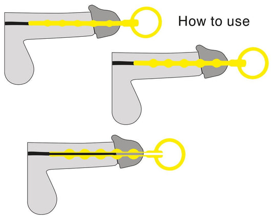 Set 3 Divaricatore Uretra